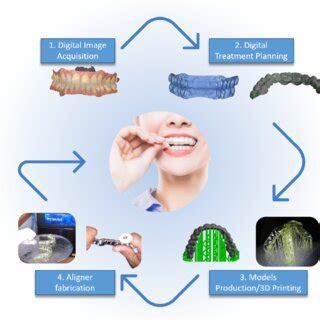 Workflow Of Fabrication Of Clear Aligners By The Thermoforming Process