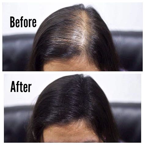 Mua Thick Fiber Hair Building Fibers For Thinning Hair Bald Spots