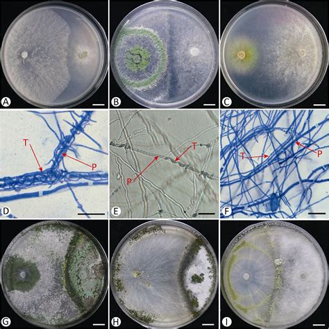 First Step Evaluation Of Trichoderma Antagonism Against Plant