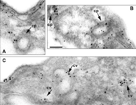 Colocalization Of Dynamin And Clathrin By Double Immunogold Labeling In