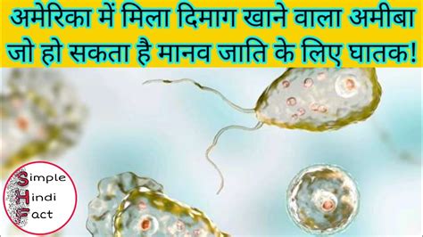 Naegleria Fowleri एक ऐसा अमीबा जो खाता है इंसान के दिमाग को जानिए