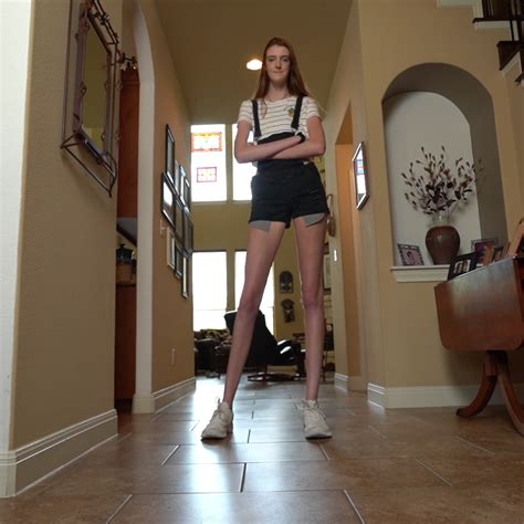 Guinness World Records Says Teen Has The Worlds Longest Legs ‘you Dont Really Fit Into The