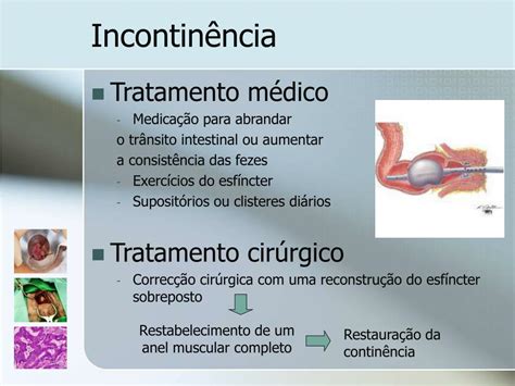 Ppt Patologia Perianal Powerpoint Presentation Free Download Id 829116