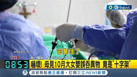 10月大女嬰看到十字架往嘴巴塞 卡食道母嚇慘 手術過程複雜嘗試多次才取出 母親讚醫師 神救援 │記者 陳姵如│【國際局勢】20231115│三立inews Youtube