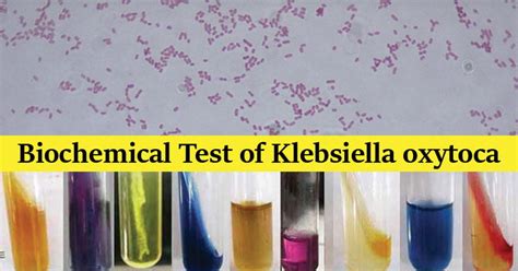 Biochemical Test Of Klebsiella Oxytoca