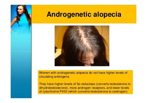 Female Hair Loss Causes And Management Androgenetic Alopecia Hair