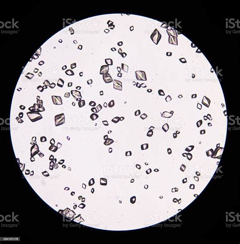 Uric Acid Crystal In Urine Sediment Stock Photo Download Image Now