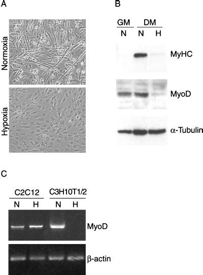 Hypoxia Regulates MyoD Protein Accumulation Hypoxia Inhibits Myogenic