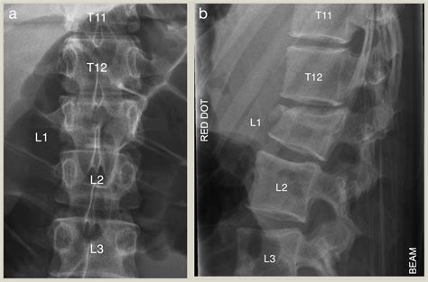 Indications And Principles Of Conservative Treatment In Injuries