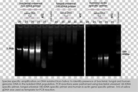 Polyacrylamide Gel Electrophoresis Polymerase Chain Reaction