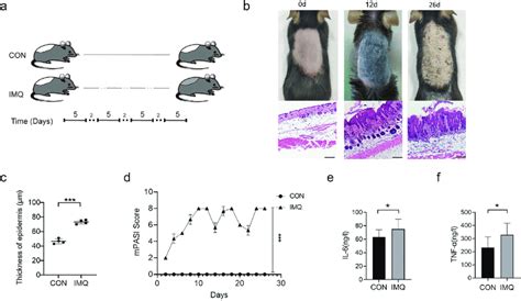 imq induced psoriasis  mouse model  schematic diagram