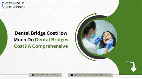 Ppt Dental Bridge Costhow Much Do Dental Bridges Cost A Comprehensive