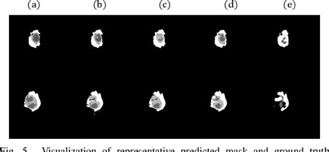 Figure From Multi Modal Brain Tumor Segmentation Via Missing Modality