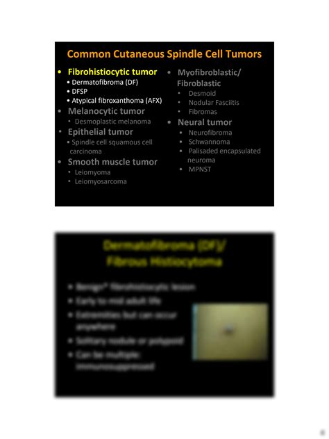 SOLUTION Phyu P Aung Challenging Differential Diagnosis Of Common