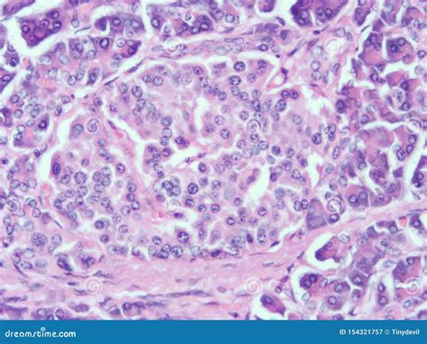 Histology Of Human Pancreas Tissue Stock Image Image Of Columnar