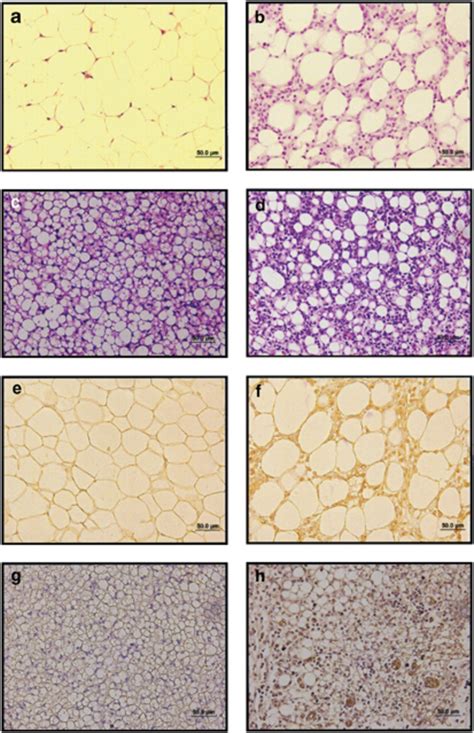 After Cotton Pellets Had Been Implanted In The Epididymal White Adipose