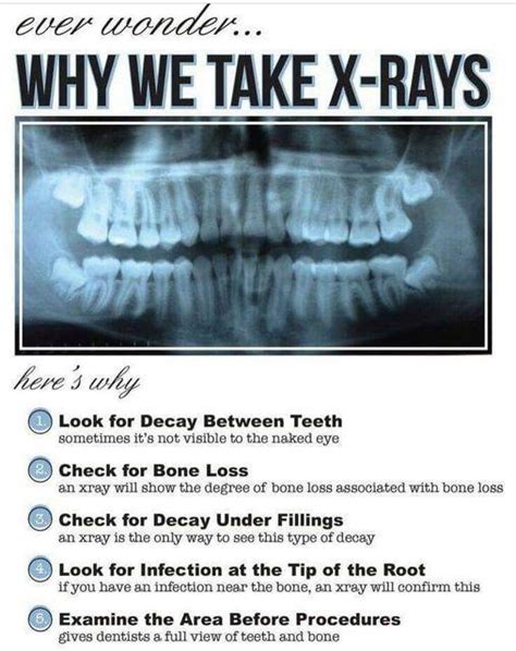 Why Do I Need Dental X-Rays At My Regular Dental Checkup?: Excellence ...