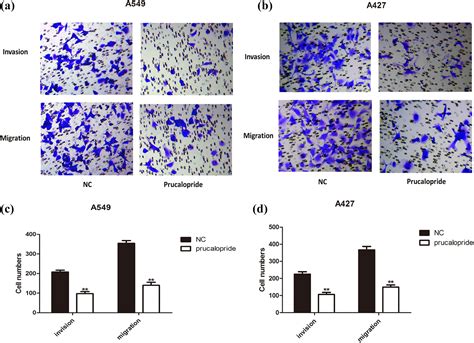 Prucalopride Inhibits Lung Cancer Cell Proliferation Invasion And