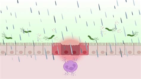 MIT GSHield A Synthetic Biology Solution To Oral Mucositis 2022