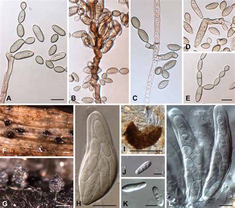 Cladosporium Herbarum Cpc 11600 Anamorphic And Teleomorphic States