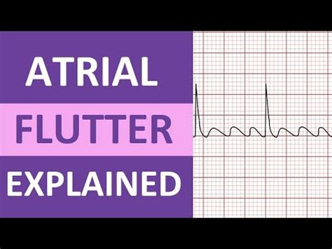 Atrial Flutter (a-flutter) ECG/EKG Nursing Review