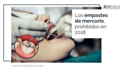 Los empastes de mercurio prohibidos en 2018 Clínica Doctor Calvo