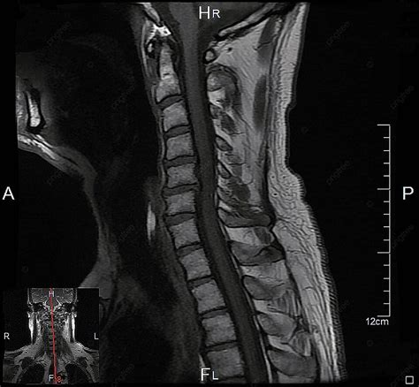 Magnetresonanztomographie Background Images HD Pictures And Wallpaper