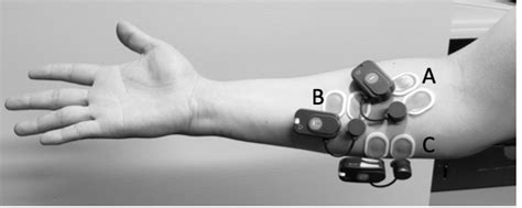 Flexor Pronator Mass Training Exercises Selectively Activate Forearm