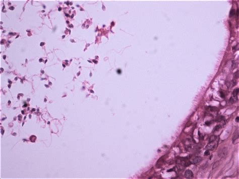 Vas Deferens Histology