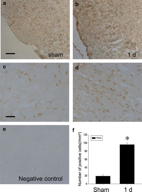 PRDM5 Distribution In The Rat Cerebral Cortex After LPS Injection