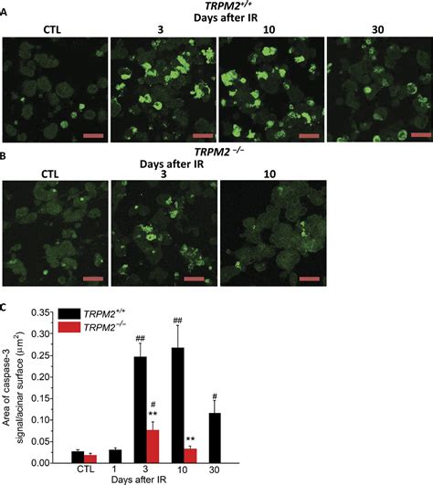 Radiation Inhibits Salivary Gland Function By Promoting STIM1 Cleavage