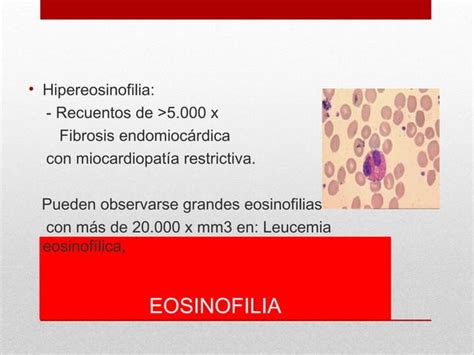 Interpretacion Del Hemograma Ppt