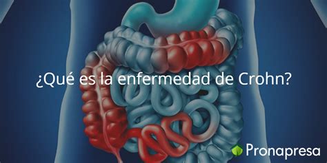 Qu Es La Enfermedad De Crohn Pronapresa