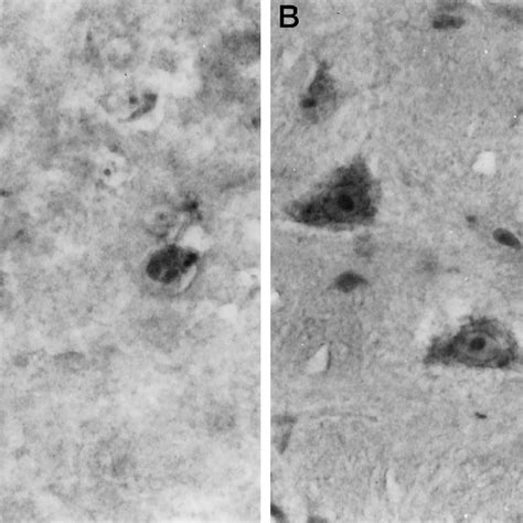 Nadph Diaphorase Staining Of Sections From Normal And Scrapie Infected