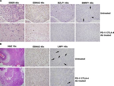 Pd 1ctla 4 Blockade Decreases The Number Of Latently And Lytically