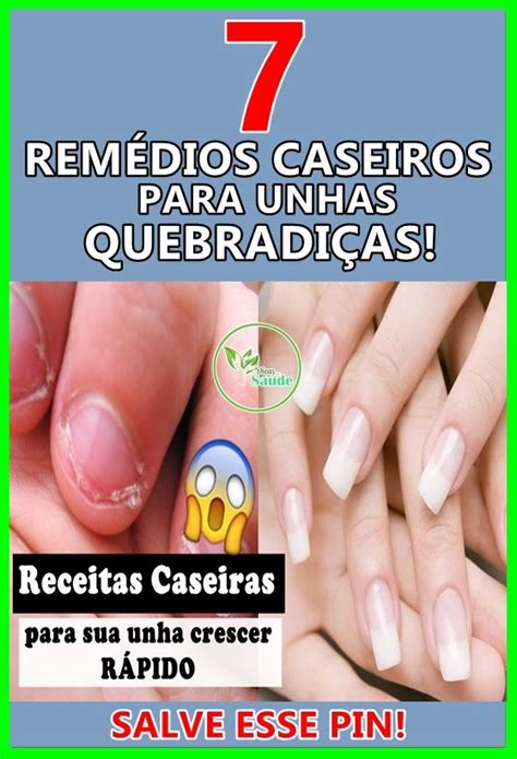 Rem Dios Caseiros Para Unhas Quebradi As Unhas Quebradi As Unhas