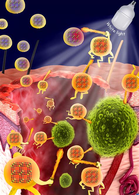 Breakthrough in wound healing: Using nanoparticles to fight antibiotic ...