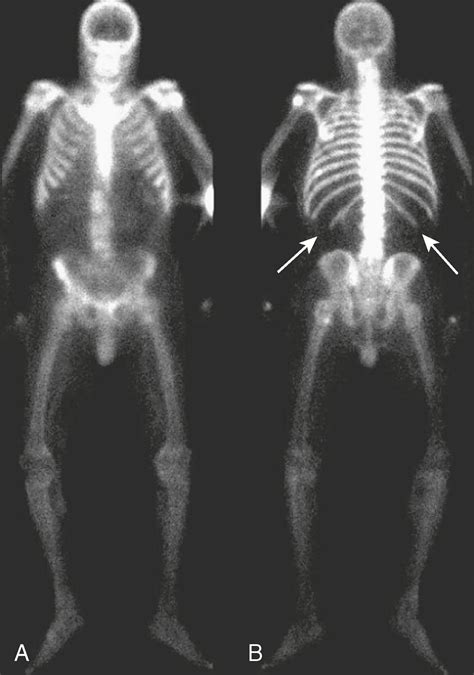 Recognizing Nontraumatic Abnormalities Of The Appendicular Skeleton And