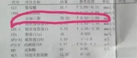 甘油三酯高的人，都会有哪些表现？医生告诉您如何预防！ 知乎