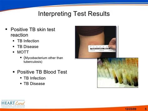 Tb Terminology