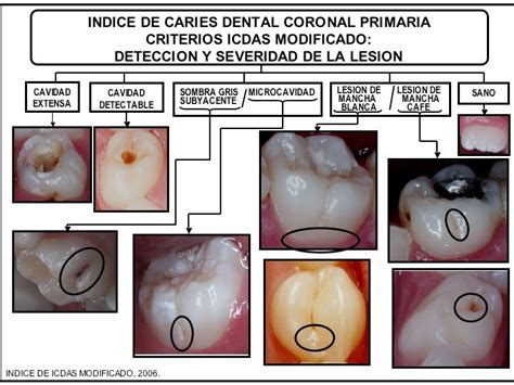 Odontología Unah Vs Guia De Diagnostico Prevencion Y Tratamiento De