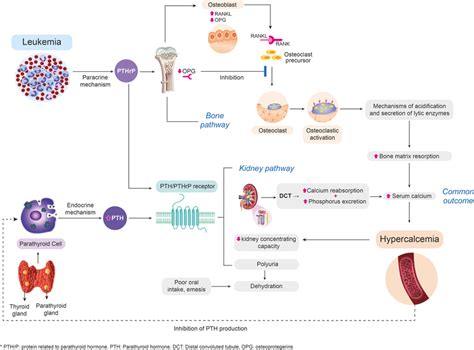 Approach To The Pathophysiological Way To Hypercalcemia Of Malignancy