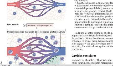 2a Inflamacion Aguda Y Cronica Robbins Youtube