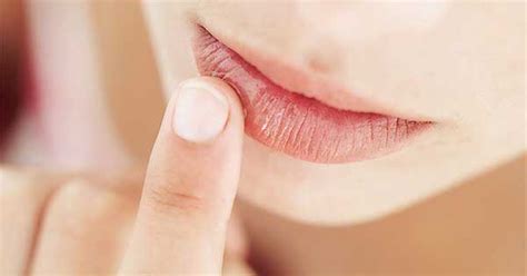 7 Consejos Para Prevenir Y Tratar Los Labios Secos Y Agrietados