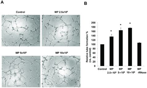 In Vitro Angiogenic Effects Of MPs A Representative Images Of