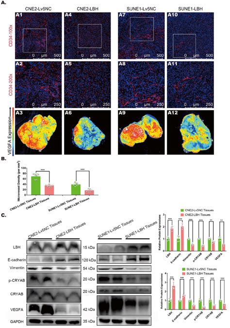 Lbh Overexpression Is Correlated With Inhibited Emt Progression