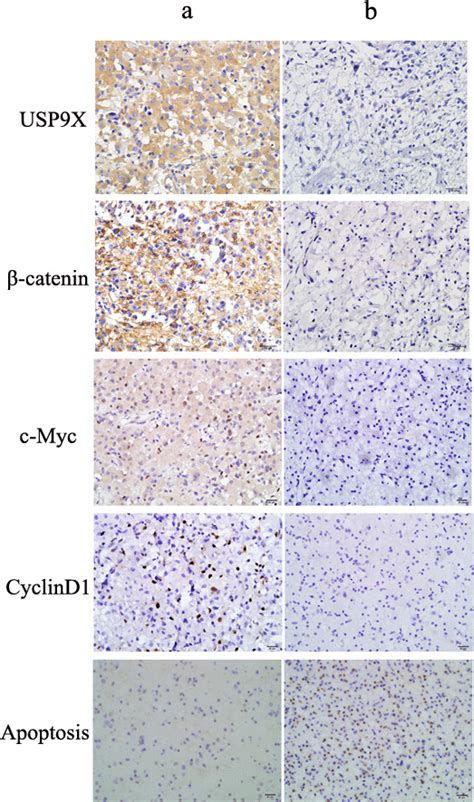 Representative Immunohistochemical Staining For Usp X Catenin C Myc