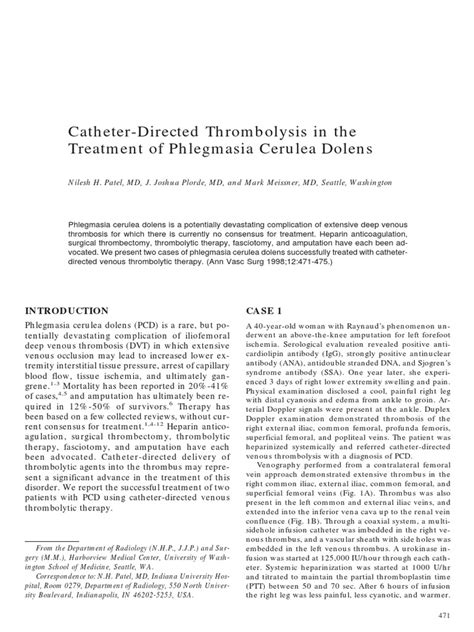 Catheter Directed Thrombolysis In The Treatment Of Phlegmasia Cerulea