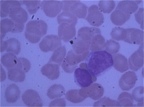 Lymphocyte Histology.