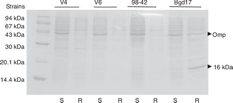 Figure 1 From Two Different Mechanisms Of Ampicillin Resistance